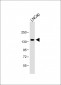 POTEE Antibody (Center)